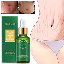 Load image into Gallery viewer, Pregnancy Scars &amp; Stretch Marks Repair Essential Oil (30mL)
