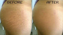 Load image into Gallery viewer, Pregnancy Scars &amp; Stretch Marks  Repairing Cream