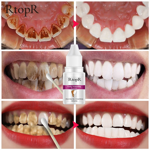 Plaque & Stains Removal Essence
