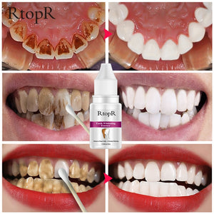 Plaque & Stains Removal Essence