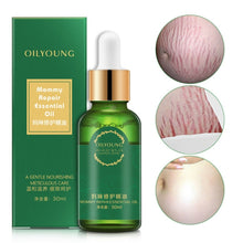 Load image into Gallery viewer, Pregnancy Scars &amp; Stretch Marks Repair Essential Oil (30mL)