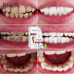 Plaque & Stains Removal Essence