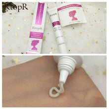 Load image into Gallery viewer, Scar  Marks Remover Cream