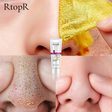 Load image into Gallery viewer, Gold  Blackhead Remover Mask
