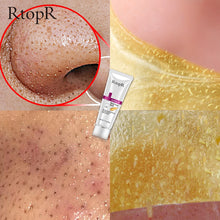 Load image into Gallery viewer, Gold  Blackhead Remover Mask