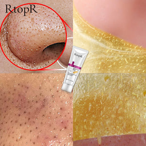 Gold  Blackhead Remover Mask