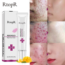 Load image into Gallery viewer, Mango Acne Repair Cream