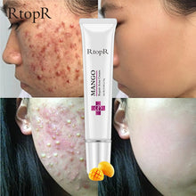 Load image into Gallery viewer, Mango Acne Repair Cream