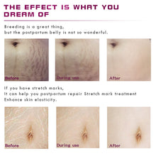 Load image into Gallery viewer, Pregnancy Scars &amp; Stretch Marks  Repairing Cream