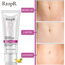 Load image into Gallery viewer, Pregnancy Scars &amp; Stretch Marks  Repairing Cream
