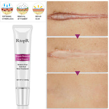 Load image into Gallery viewer, Scar  Marks Remover Cream