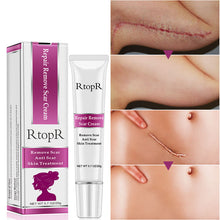 Load image into Gallery viewer, Scar  Marks Remover Cream