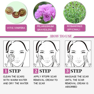 Scar  Marks Remover Cream