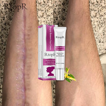 Load image into Gallery viewer, Scar  Marks Remover Cream
