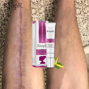 Scar  Marks Remover Cream